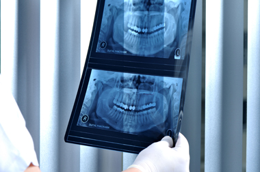 Digital Dental X-Ray