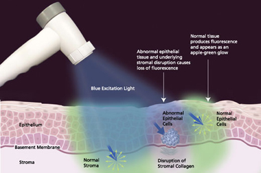 Oral Cancer Screening